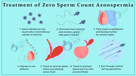 nep sperma|Azoospermia (Zero Sperm Count): Causes & Treatment